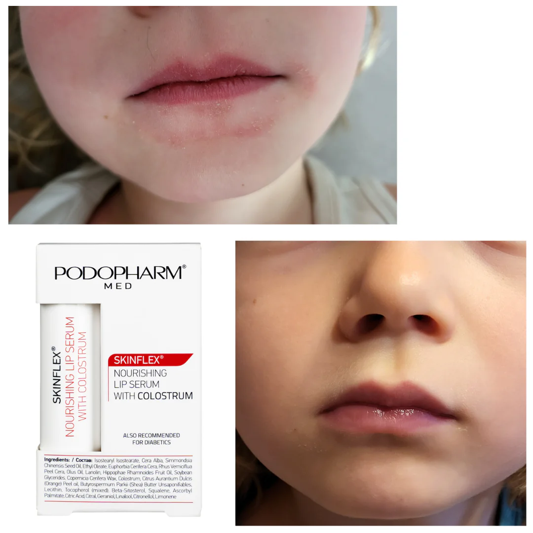 Lip Serum With Colostrum, toitev huulepalsam ternespiimaga (4,9g) - Image 3