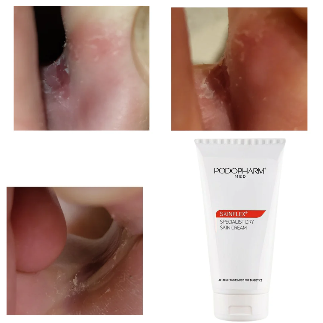 Specialist Dry Skin Cream, spetsiaalne kuiva naha kreem (150ml) - Image 5