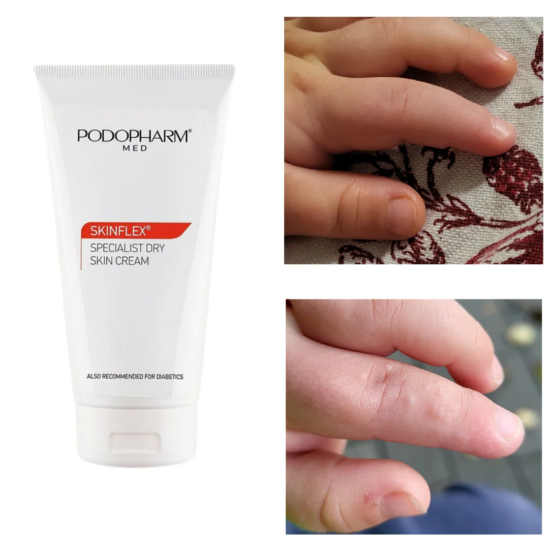 Specialist Dry Skin Cream, spetsiaalne kuiva naha kreem (150ml) - Image 4