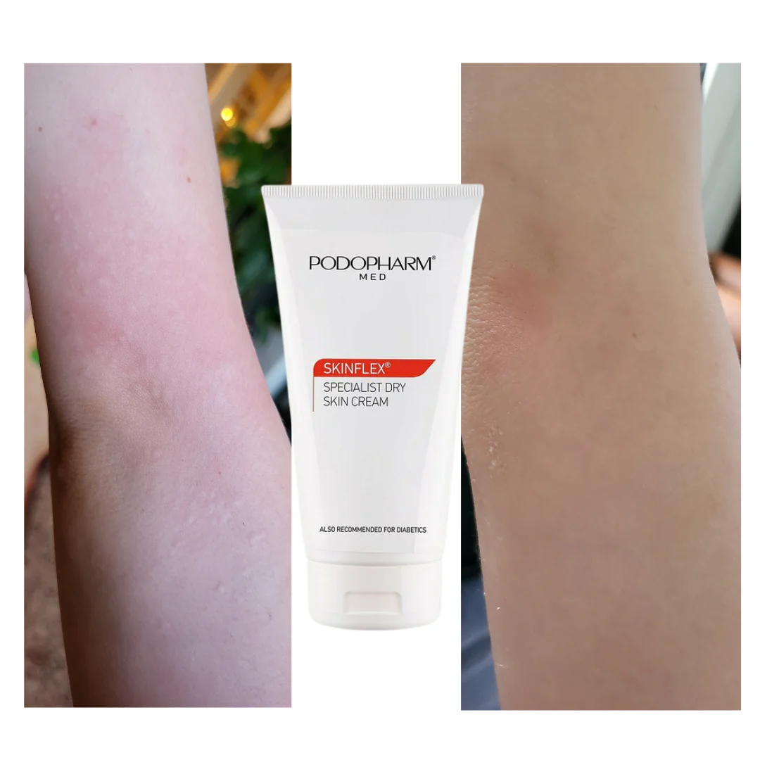 Specialist Dry Skin Cream, spetsiaalne kuiva naha kreem (150ml) - Image 3