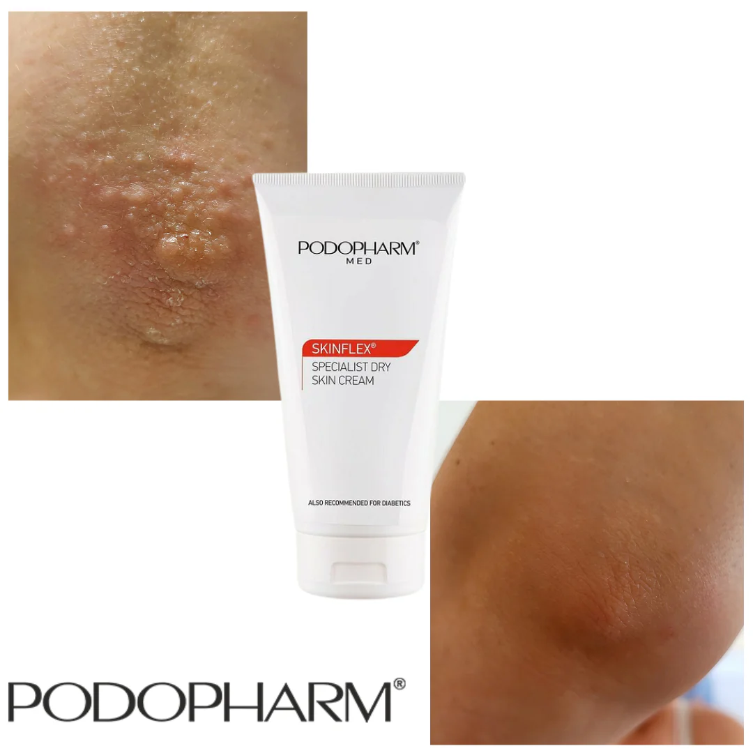 Specialist Dry Skin Cream, spetsiaalne kuiva naha kreem (150ml) - Image 2