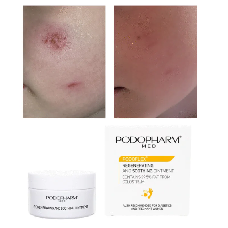 Regenerating and Soothing Ointment, ternespiimasalv (60ml) - Image 3