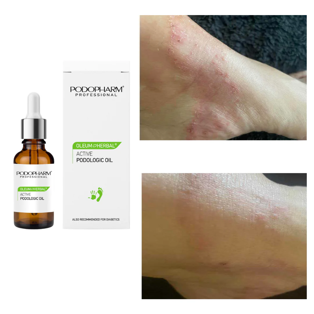 Oleum Herbal Active Podological Oil, podoloogiline õli, 10ml - Image 2