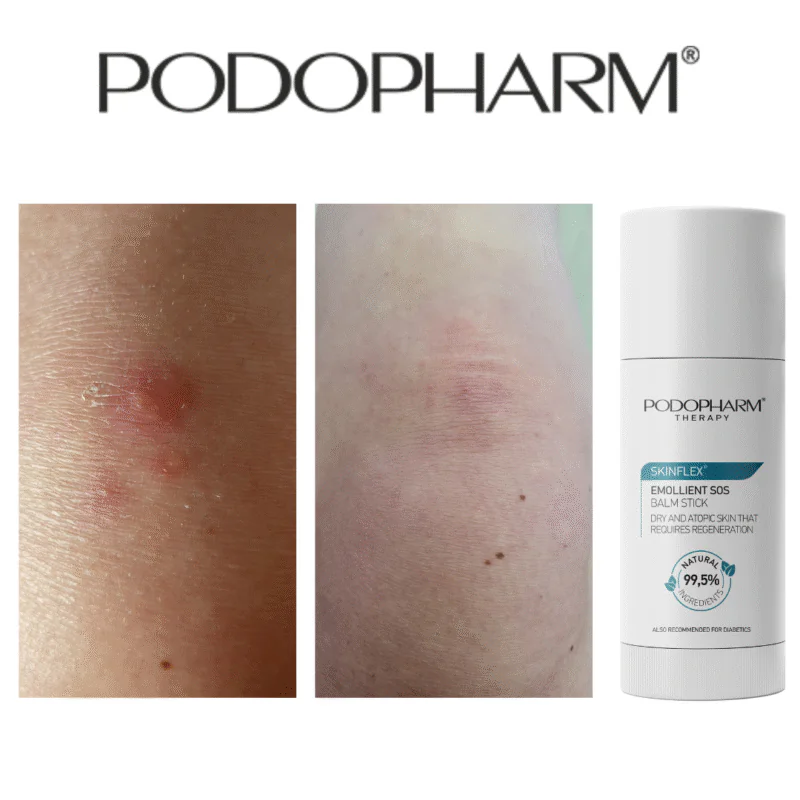 Emollient SOS balm stick, nahka pehmendav palsamipulk 50g - Image 2