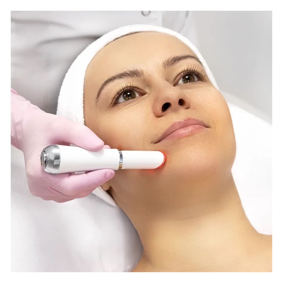 Eye & Lip Beauty Massager, silmade ja huulte massaažiseade - Image 5