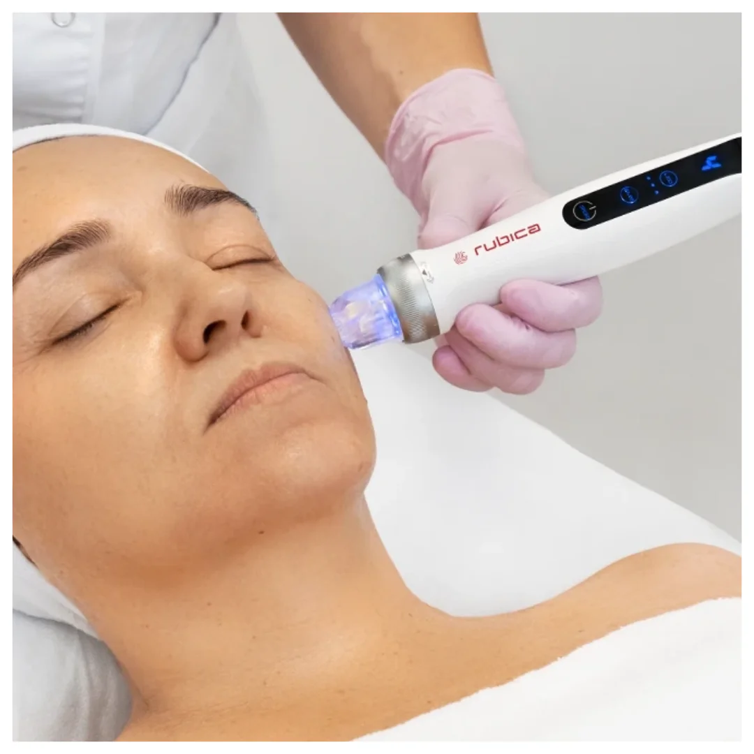 Electroporation Pen, mikronõelumine mikrovoolude (EMS) ja LED-valgusteraapiaga. - Image 5