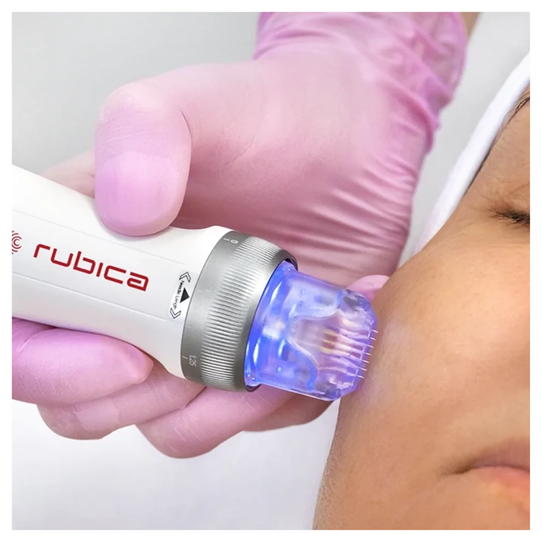 Electroporation Pen, mikronõelumine mikrovoolude (EMS) ja LED-valgusteraapiaga. - Image 3