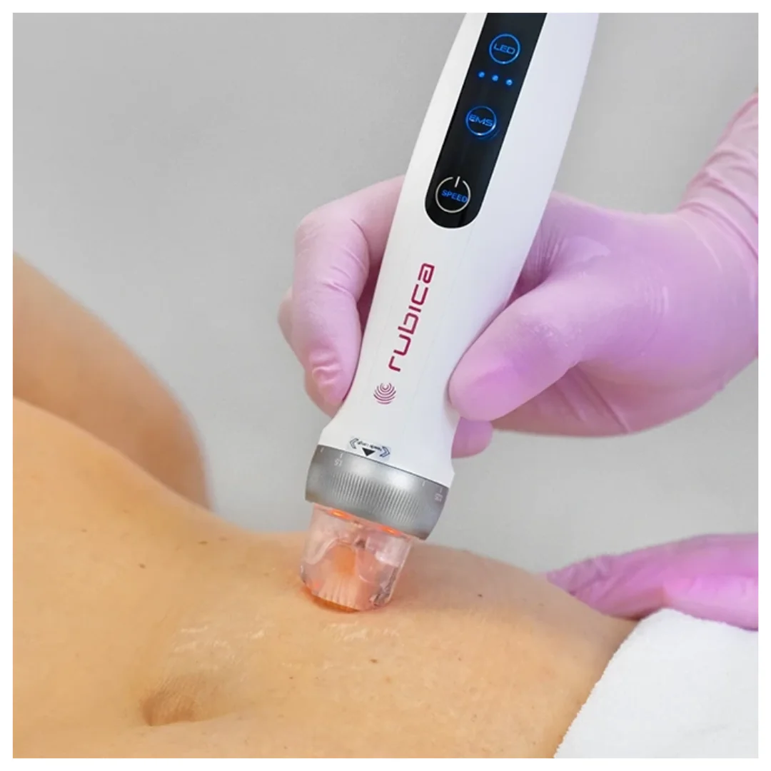 Electroporation Pen, mikronõelumine mikrovoolude (EMS) ja LED-valgusteraapiaga. - Image 4