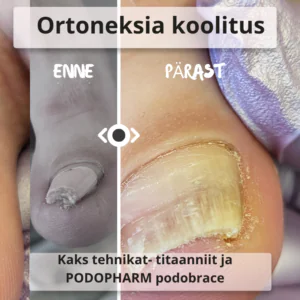 Ortoneksia koolitus koos stardikomplektiga