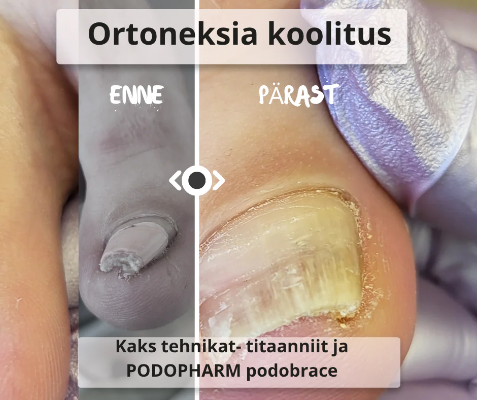Ortoneksia koolitus koos stardikomplektiga