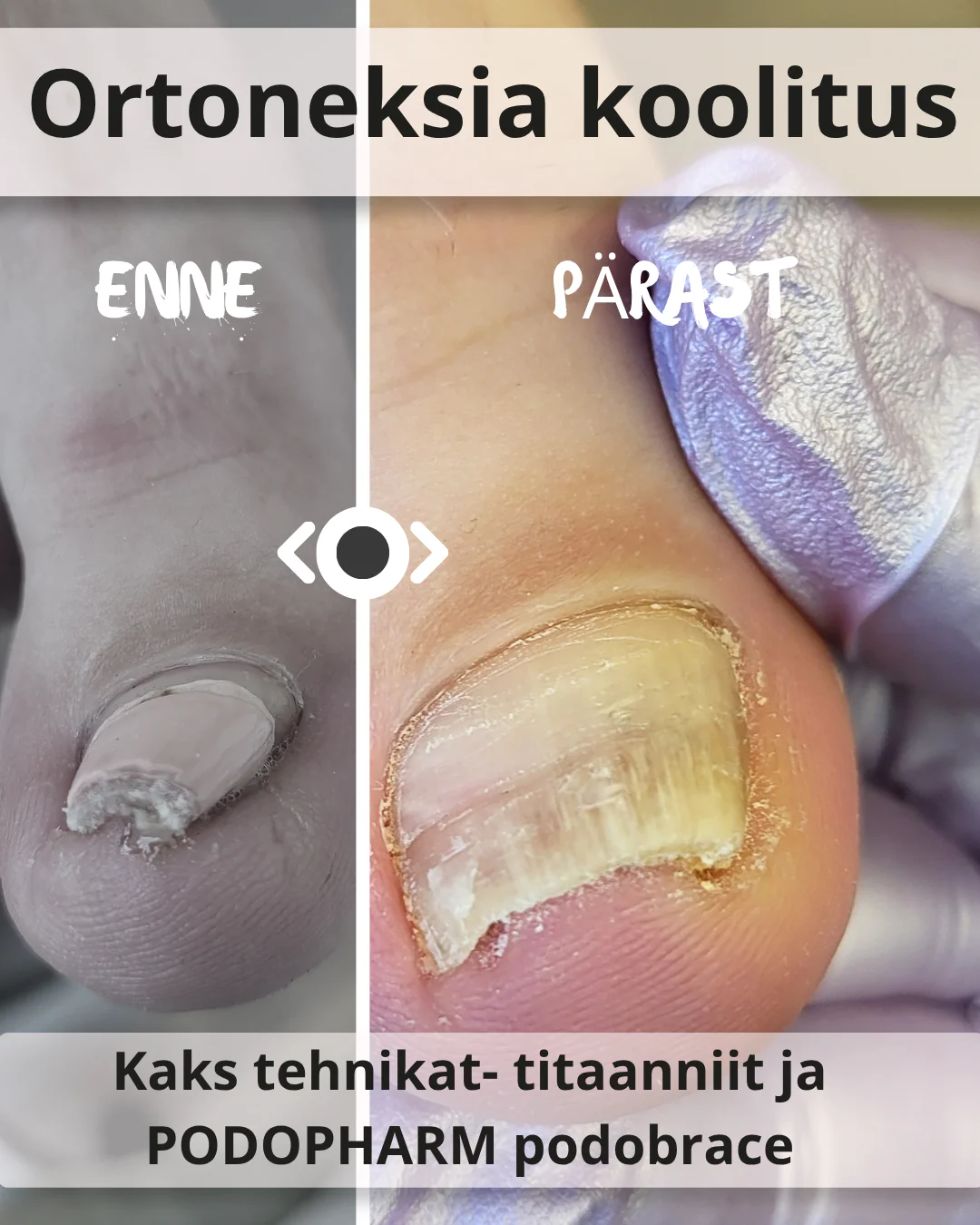 19.01.2026 Ortoneksia koolitus