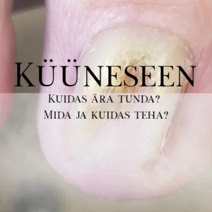 4.03.2026 Koolitus "Küüneseen"