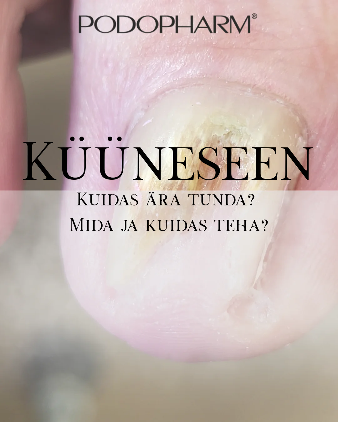 4.03.2026 Koolitus "Küüneseen"