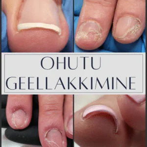 20.01.2026 Koolitus "Ohutu geellakkimine"