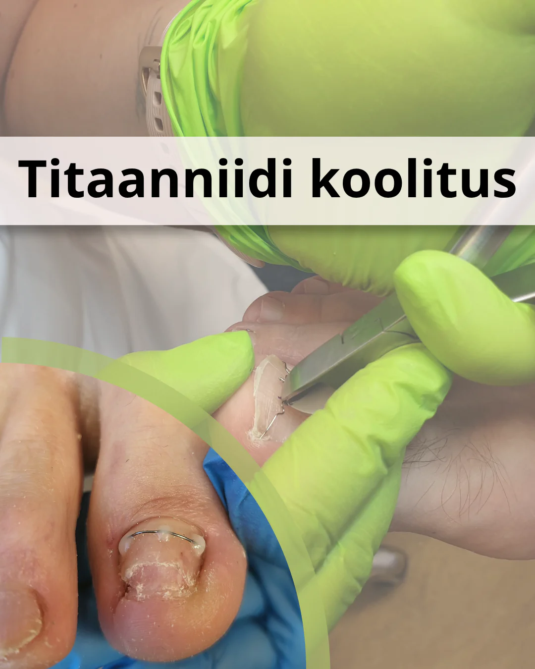 12.01.2026 Titaanniidi koolitus